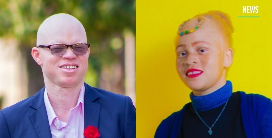 ALBINISM: The color of love