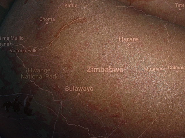 ZIM: Measles outbreak kills 700 children
