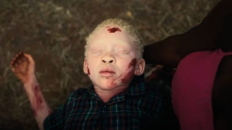 From Devotion to Rejection: The powerful narrative of albinism and societal stigma in ‘Can You See Us?’ film